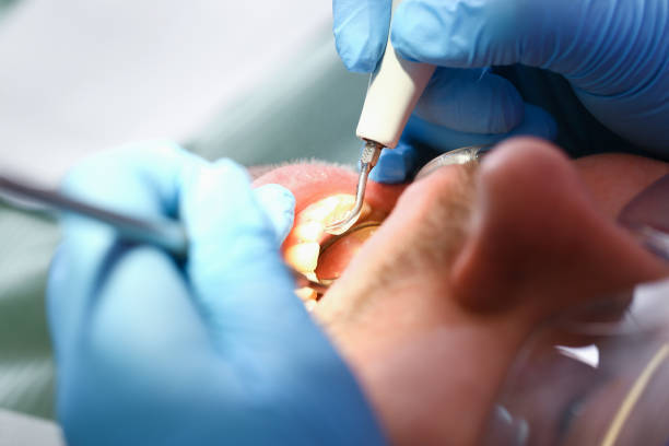 Best After-Hours Dental Care in Chesapeake, WV