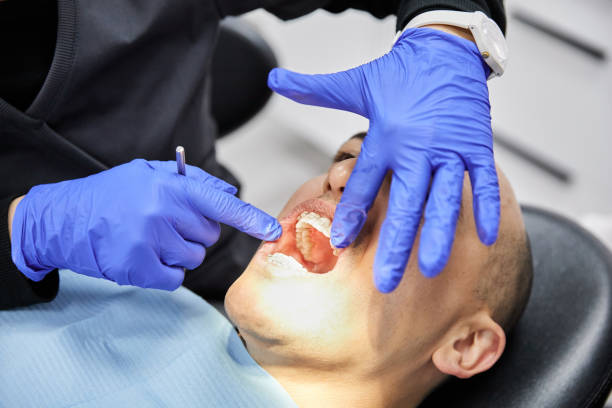 Best Emergency Wisdom Tooth Extraction in Chesapeake, WV
